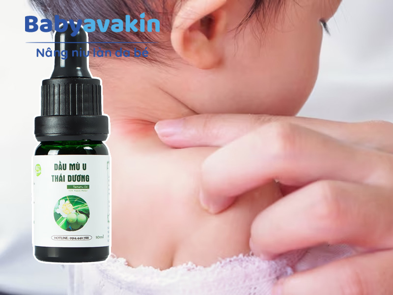 Massage cho bé bằng dầu Mù U có thể làm dịu tình trạng hăm của bé